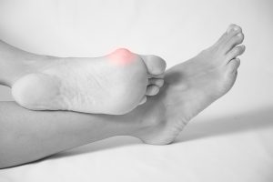 What causes foot bunions