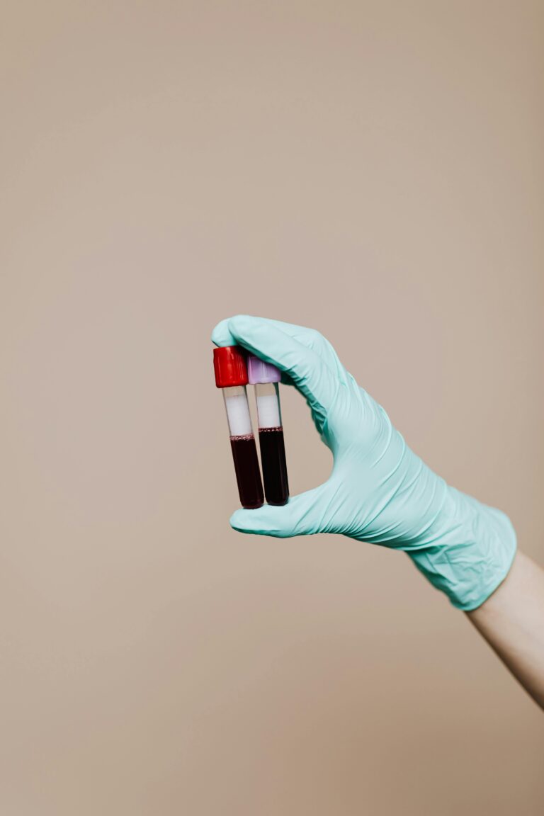 PRP Plasma riche en plaquette